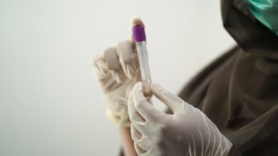 África declara emergência sanitária devido ao vírus mpox