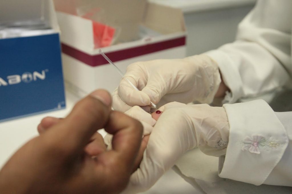 Teste rápido de HIV