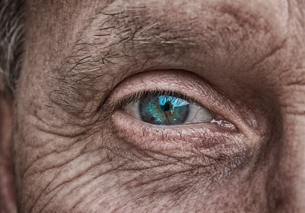 Longa exposição dos olhos ao sol pode causar nove doenças oculares