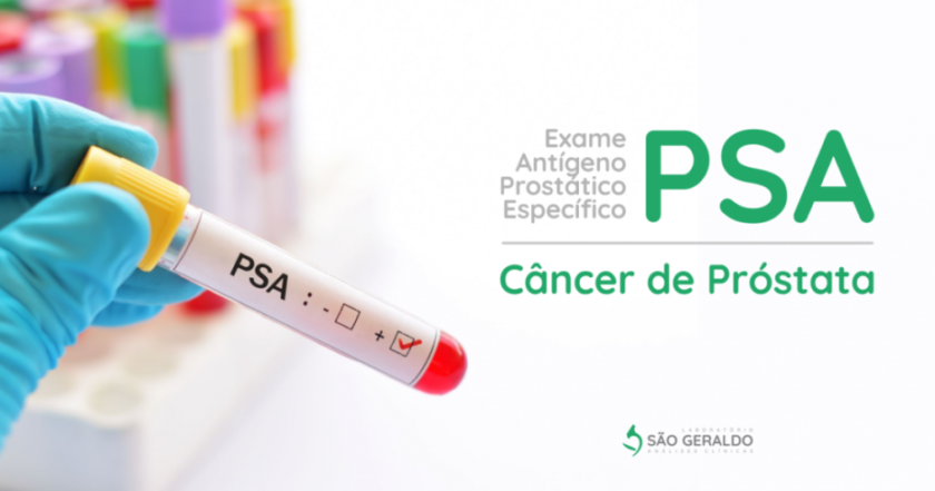 Projeto do RN quer tornar gratuito teste que detecta câncer de próstata exame de PSA Antígeno Prostático Específico