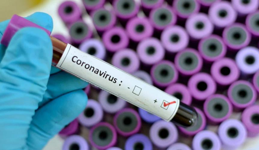 Dos 100 casos positivos de coronavírus em Parnamirim 31 já estão curados