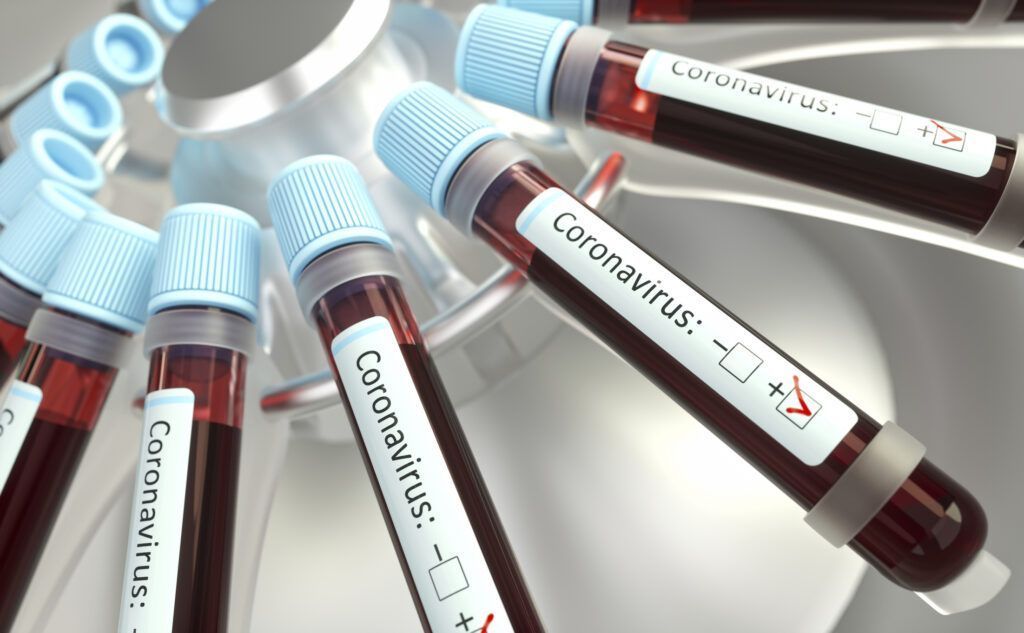 Dos 312 casos positivos de coronavírus em Natal 219 já estão curados