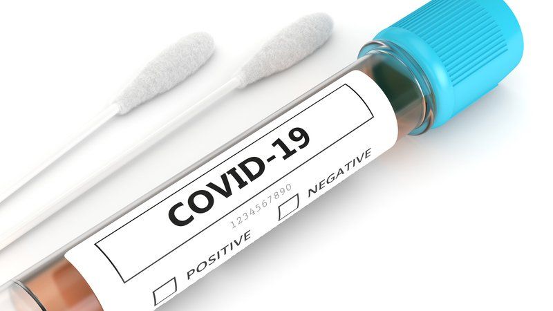 Como funcionam os testes para detectar a covid-19