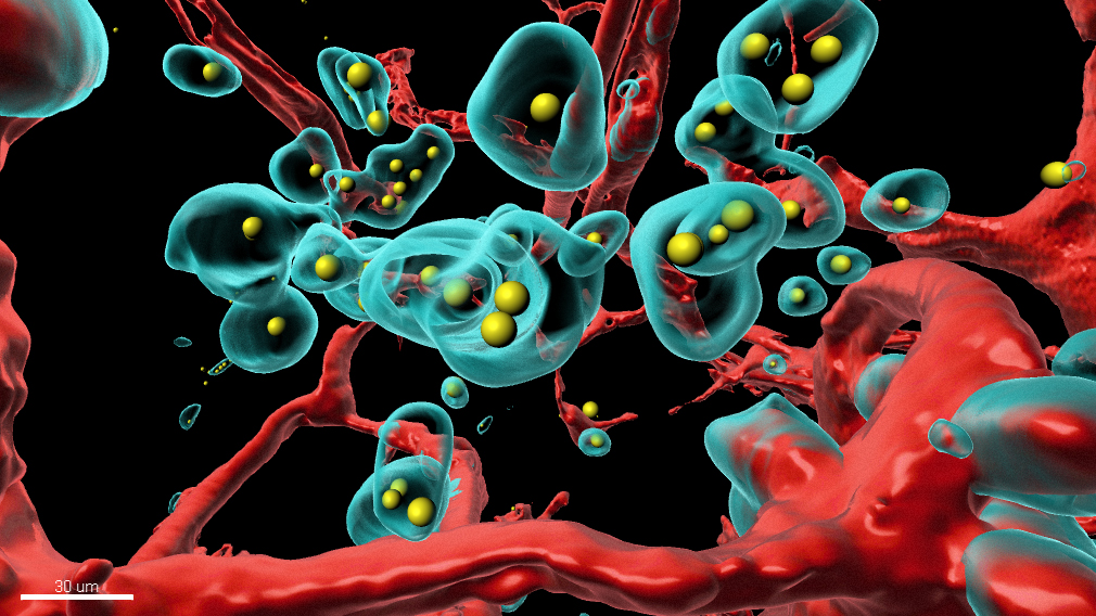 Cientistas criam um vírus que pode combater o câncer adenovírus