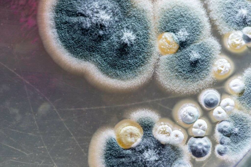 Sesap confirma primeiro caso de mucormicose fungo negro em paciente do RN que teve Covid