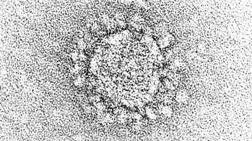 O coronavírus pode infectar e possivelmente se esconder nas células de gordura