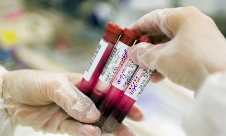 Cientistas desenvolvem exame de sangue capaz de detectar câncer de pulmão precocemente